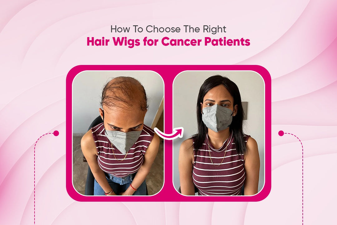 How To Choose The Right Hair Wigs for Cancer Patients